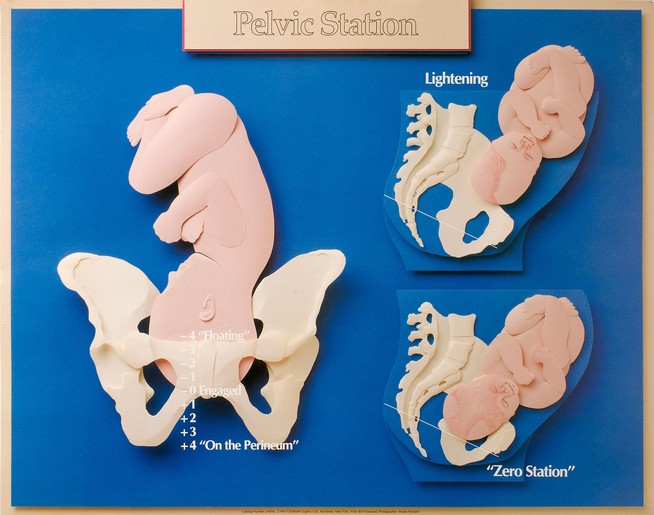 338_showcase_project_detail_item