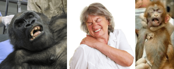 Why do We and Other Animals Wince When in&nbsp;Pain?